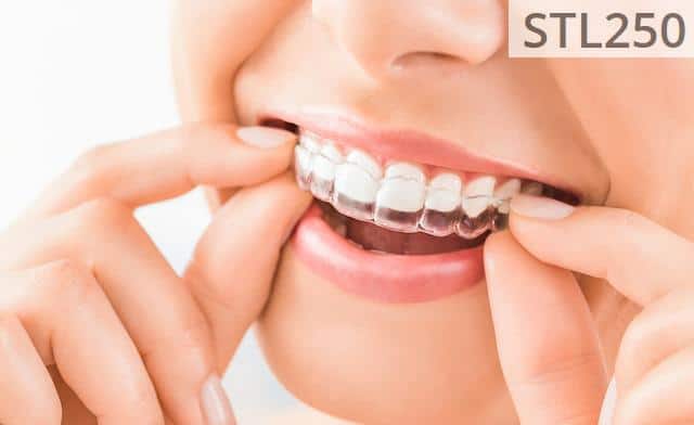 clínicas dentales en Barcelona para ortodoncia invisible